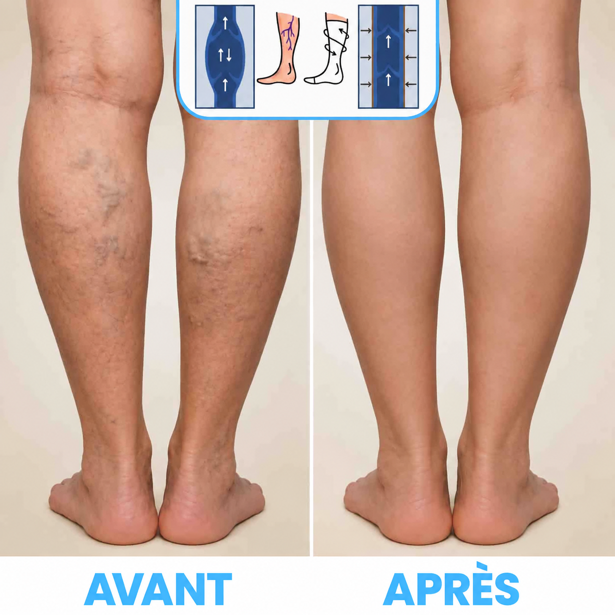 FlowSocks — visuel avant et après